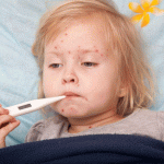 Cách phòng tránh bệnh sởi hiệu quả cho bé